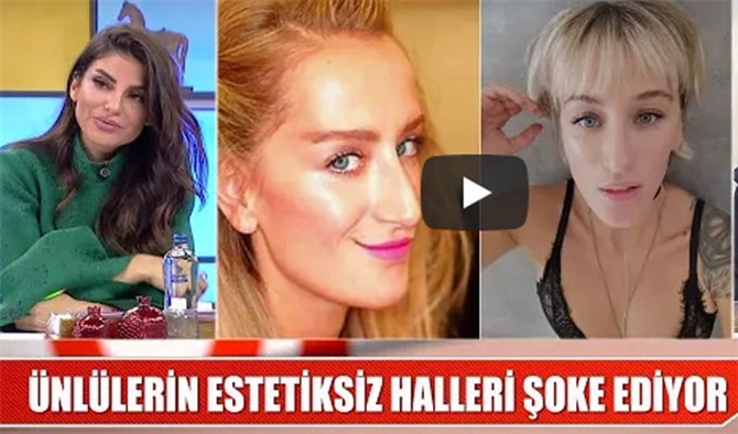 Söylemezsem Olmaz 15 Mart Ünlülerin estetiksiz halleri şok etti