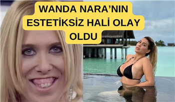 Wanda Nara'nın estetiksiz hali şaşkına çevirdi